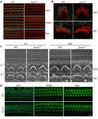 <mark class="highlighted">Annexin A4</mark> Is Dispensable for Hair Cell Development and Function